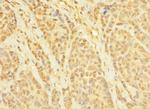 CCDC79 Antibody in Immunohistochemistry (Paraffin) (IHC (P))