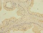 CCDC79 Antibody in Immunohistochemistry (Paraffin) (IHC (P))