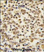 ERK5 Antibody in Immunohistochemistry (Paraffin) (IHC (P))