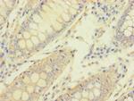 MACROD1 Antibody in Immunohistochemistry (Paraffin) (IHC (P))