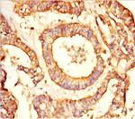 NRBP2 Antibody in Immunohistochemistry (Paraffin) (IHC (P))