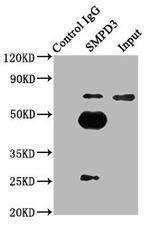 SMPD3 Antibody in Immunoprecipitation (IP)