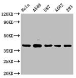 PIH1D1 Antibody in Western Blot (WB)