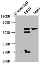 PSG1 Antibody in Immunoprecipitation (IP)