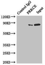 PKC epsilon Antibody in Immunoprecipitation (IP)