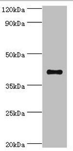 SULT2B1 Antibody in Western Blot (WB)