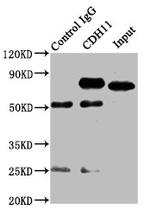 CDH11 Antibody in Immunoprecipitation (IP)