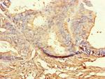 BUBR1 Antibody in Immunohistochemistry (Paraffin) (IHC (P))