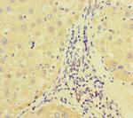 E2F1 Antibody in Immunohistochemistry (Paraffin) (IHC (P))