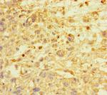 E2F1 Antibody in Immunohistochemistry (Paraffin) (IHC (P))