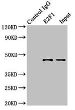 E2F1 Antibody in Immunoprecipitation (IP)