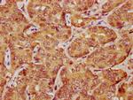 LATS1 Antibody in Immunohistochemistry (Paraffin) (IHC (P))