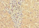 STAT3 Antibody in Immunohistochemistry (Paraffin) (IHC (P))