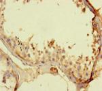 TALK-1 Antibody in Immunohistochemistry (Paraffin) (IHC (P))