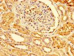 PRDX3 Antibody in Immunohistochemistry (Paraffin) (IHC (P))