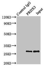 PRDX3 Antibody in Immunoprecipitation (IP)