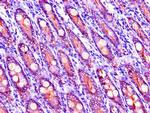 LIPG Antibody in Immunohistochemistry (Paraffin) (IHC (P))