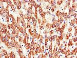 ATP5A1 Antibody in Immunohistochemistry (Paraffin) (IHC (P))