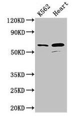 ATP5A1 Antibody in Western Blot (WB)