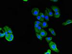 GARS Antibody in Immunocytochemistry (ICC/IF)