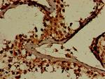 GARS Antibody in Immunohistochemistry (Paraffin) (IHC (P))