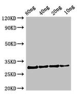 Profilin 1 Antibody in Western Blot (WB)