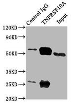 DR4 Antibody in Immunoprecipitation (IP)