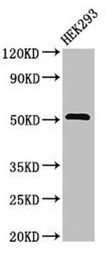 DR4 Antibody in Western Blot (WB)