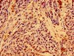 C19orf12 Antibody in Immunohistochemistry (Paraffin) (IHC (P))