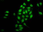 NUP98 Antibody in Immunocytochemistry (ICC/IF)