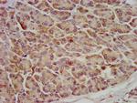 OCC1 Antibody in Immunohistochemistry (Paraffin) (IHC (P))