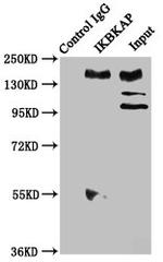 IKAP Antibody in Immunoprecipitation (IP)