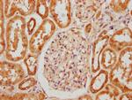 OTOG Antibody in Immunohistochemistry (Paraffin) (IHC (P))