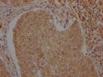 ATF6 Antibody in Immunohistochemistry (Paraffin) (IHC (P))