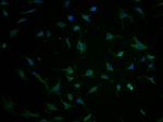 TBC1D3G Antibody in Immunocytochemistry (ICC/IF)