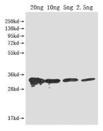 PFP-BETA1 Antibody in Western Blot (WB)