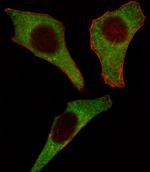 CDK4 Antibody in Immunocytochemistry (ICC/IF)