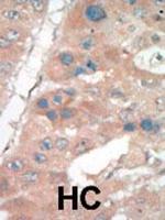 p21 Antibody in Immunohistochemistry (Paraffin) (IHC (P))