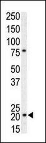 p21 Antibody in Western Blot (WB)