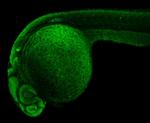 SOX2 Antibody in Immunohistochemistry (IHC)