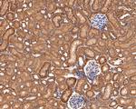 IL-22 Receptor alpha Antibody in Immunohistochemistry (Paraffin) (IHC (P))