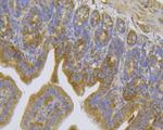 TRPV6 Antibody in Immunohistochemistry (Paraffin) (IHC (P))