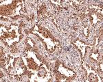 PSMB7 Antibody in Immunohistochemistry (Paraffin) (IHC (P))