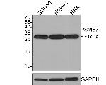 PSMB7 Antibody in Western Blot (WB)