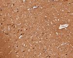 Calcineurin B Antibody in Immunohistochemistry (Paraffin) (IHC (P))