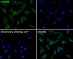 PSMB6 Antibody in Immunocytochemistry (ICC/IF)