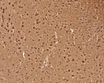 PSMB6 Antibody in Immunohistochemistry (Paraffin) (IHC (P))