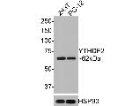 YTHDF2 Antibody in Western Blot (WB)