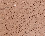 PSMC5 Antibody in Immunohistochemistry (Paraffin) (IHC (P))