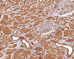 PSMC5 Antibody in Immunohistochemistry (Paraffin) (IHC (P))